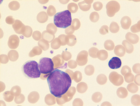 BALL-Blasts-in-blood