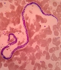 THE NIGHT TRAVELLER– MICROFILARIA IN PERIPHERAL BLOOD SMEAR