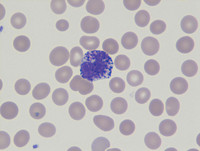 Basophil