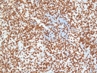 EBV-reactivationCD3