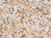 EBV-reactivationCD4