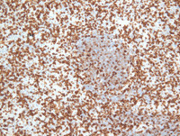 EBV-reactivationCD5