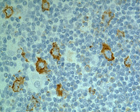 NLPHL-with-progression