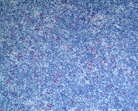 NLPHL-with-progression