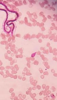 Identifying Concomitant Parasitism in an Individual Host