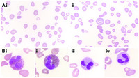 When eosinophils spill the beans…