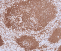 Progressive Transformation of Germinal Centers