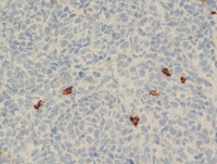 IHC CD8