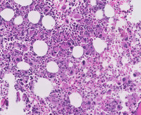 CMLAccelerated-PhaseHE