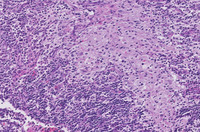 SHMLHE-Intermediate-Power