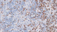 Germinotropic-Lymphoproliferative-DisorderCD3