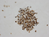 Primary-Effusion-LymphomaCD45