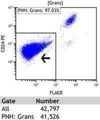 Paroxysmal-Nocturnal-HemoglobinuriaFlow-Plots