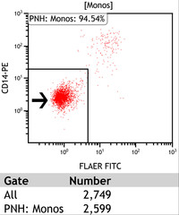 Paroxysmal-Nocturnal-HemoglobinuriaFlow-Plots