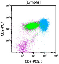 Chronic-Lymphoproliferative-Disorder-of-NK-Cells--Flow-Plots