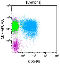 Chronic-Lymphoproliferative-Disorder-of-NK-Cells--Flow-Plots