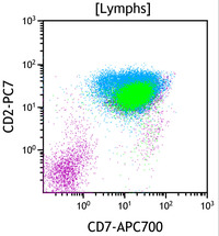 Chronic-Lymphoproliferative-Disorder-of-NK-Cells--Flow-Plots