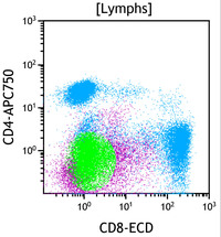 Chronic-Lymphoproliferative-Disorder-of-NK-Cells--Flow-Plots