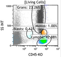 Chronic-Lymphoproliferative-Disorder-of-NK-Cells--Flow-Plots