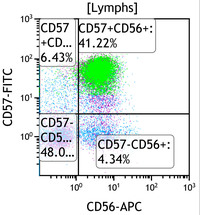 Chronic-Lymphoproliferative-Disorder-of-NK-Cells--Flow-Plots