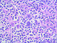 NLPHL HE LP CELLS