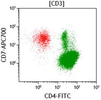 Sezary-syndromeImmunophenotype