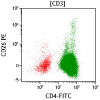 Sezary-syndromeImmunophenotype