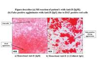 Identifying False Positive Weak Rh (D) agglutination test in DAT positive red cells