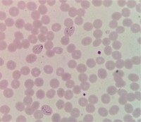 Plasmodium vivax trophozoites