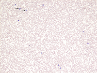 TAM smear (8 weeks) - Fig 6