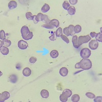Plasmodium falciparum trophozoites 1