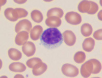 Large granular lymphocyte