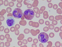 Eosinophils and lymphocyte