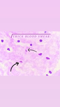 Plasmodium falciparum gametocytes 1