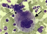 Mature Megakaryocyte