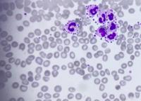 Platelet satellitism