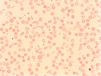 F) peripheral blood