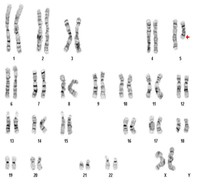 Karyotype-Studies