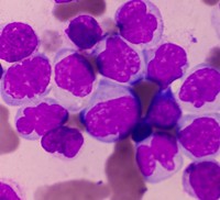 Promonocytes