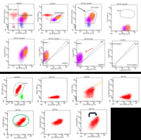 Chronic-lymphocytic-leukemia--Flow-cytometry