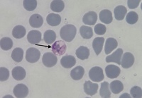 Plasmodium vivax: Trophozoite