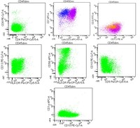 TLymphoblastic-Lymphoma--Flow-Cytometry
