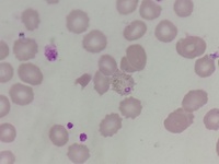 Plasmodium vivax gametocytes