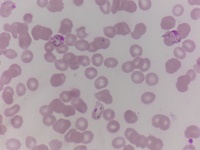 Plasmodium vivax gametocytes