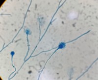 Conidiophores of Aspergillus Fumigatus