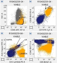 Flowcytometry findings -CD19 CD43 positive with  Lambda restriction
