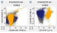 Flowcytometry findings- CD49 d positive CD23 & CD200  negative