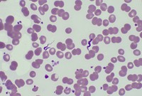 Trypanosoma rhodesiense