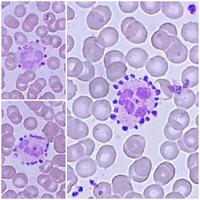 Platelet satellitism