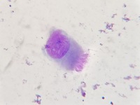 Nasal ciliated epithelial cell